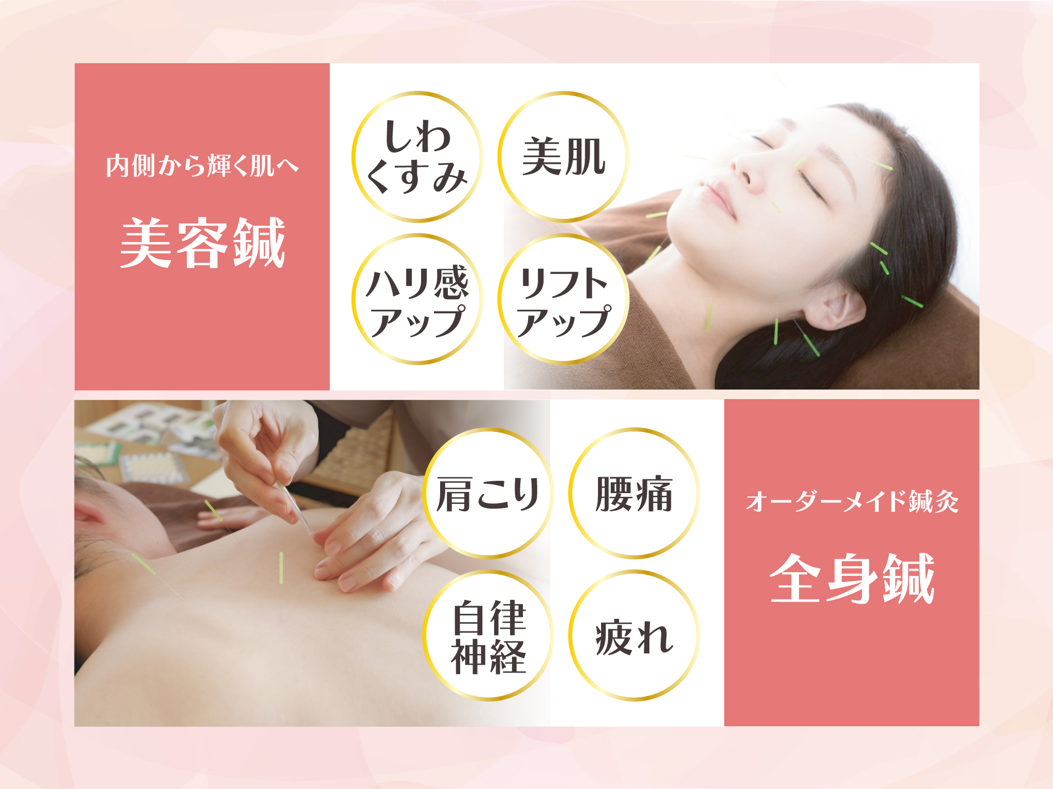 Souの鍼灸